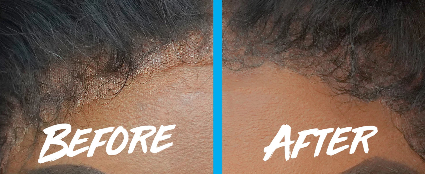 Ebin New York Wonder Lace Bond Sports Edition Adhesive Spray - Ultra Strong Hold, Ideal for Sports & Active Lifestyles