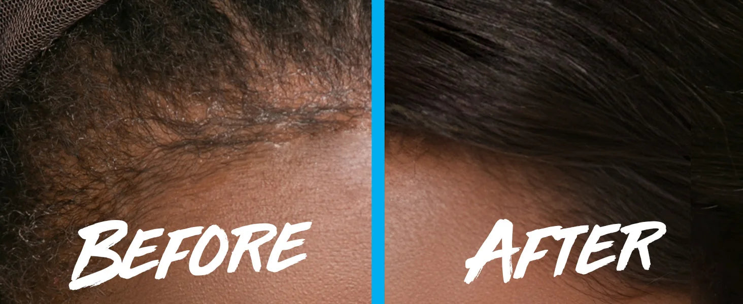 Ebin New York Wonder Lace Bond Sports Edition Lace Wig Adhesive 1.15oz/ 34ml - Extreme Hold, Perfect for Active Wear